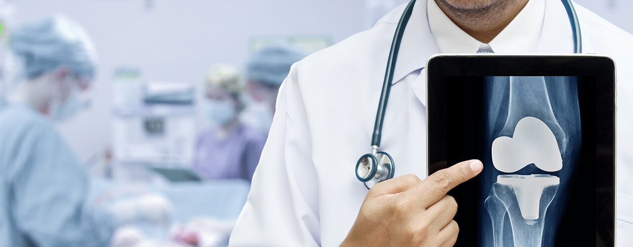 Joint Replacement Lansing, Okemos, Dewitt, Mason & Waverly, MI